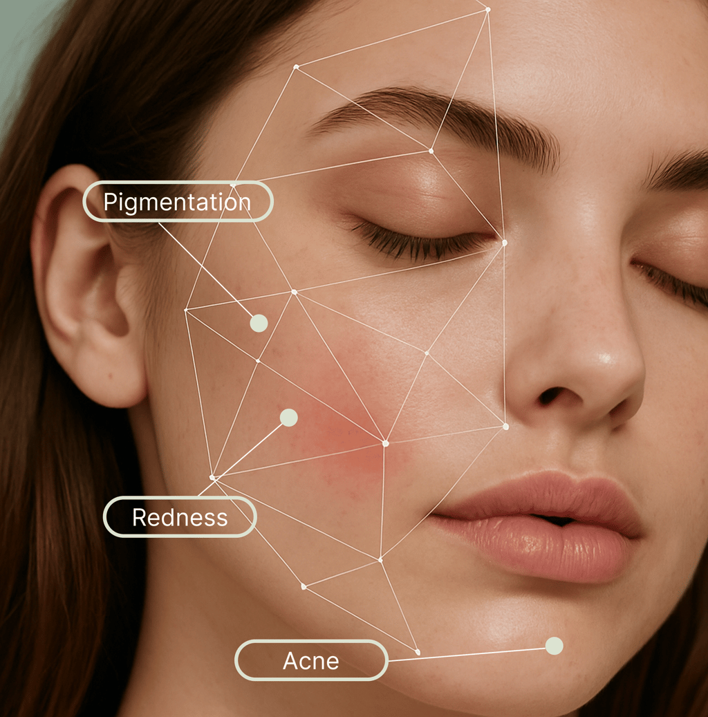 Digital skin analysis scanning a face for acne, redness, and pigmentation issues.